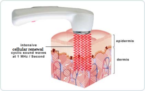 A diagram of an electric hair dryer.