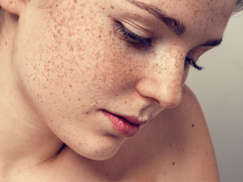 A woman with freckles is looking down at her face.