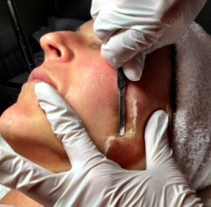 A woman getting her face waxed at the salon