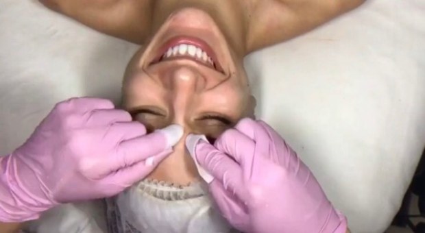 A woman is getting her teeth cleaned by two hands.